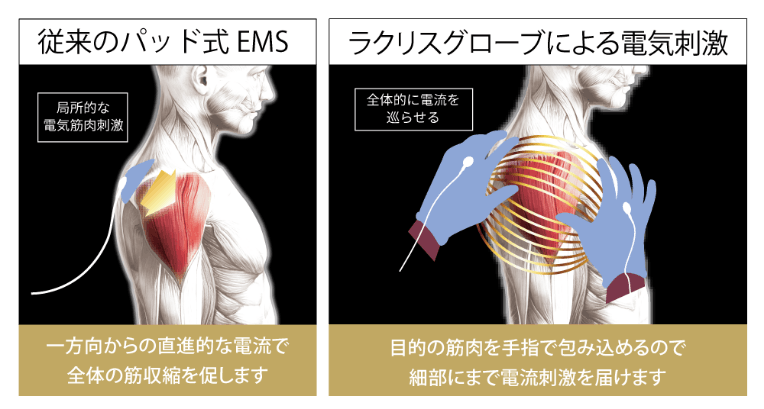 従来のパッド式EMSとラクリスグローブによる電気刺激の比較
